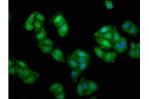 Immunofluorescence staining of HepG2 cells with ABIN7152277 at 1:135, counter-stained with DAPI. (Exopolyphosphatase PRUNE1 (PRUNE1) (AA 1-168) antibody)