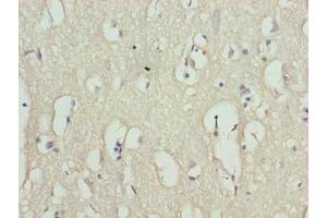 Immunohistochemistry of paraffin-embedded human brain tissue using ABIN7166851 at dilution of 1:100 (RHPN1-AS1 antibody  (AA 1-59))