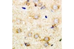 Immunohistochemical analysis of Pumilio 1 staining in mouse brain formalin fixed paraffin embedded tissue section. (PUM1 antibody)