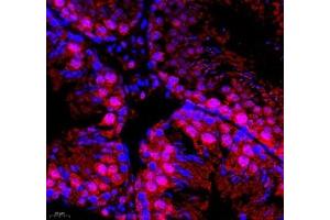 Immunofluorescence (Paraffin-embedded Sections) (IF (p)) image for anti-DMRT-Like Family A2 (DMRTA2) antibody (ABIN7073753)