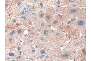 IHC-P analysis of Human Liver Tissue, with DAB staining. (ERBB3 antibody  (AA 709-966))