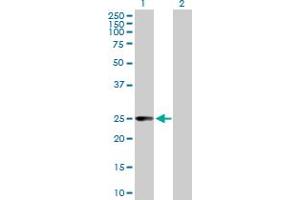Western Blot analysis of CCBL1 expression in transfected 293T cell line by CCBL1 MaxPab polyclonal antibody. (CCBL1 antibody  (AA 1-250))