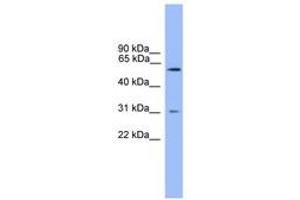 Image no. 1 for anti-Proprotein Convertase Subtilisin/kexin Type 2 (PCSK2) (AA 351-400) antibody (ABIN6746608) (PCSK2 antibody  (AA 351-400))
