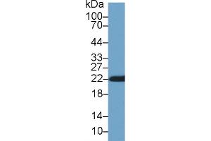 Western Blot; Sample: Rat Skin lysate; Primary Ab: 1µg/ml Rabbit Anti-Rat CYPB Antibody Second Ab: 0. (PPIB antibody  (AA 34-216))