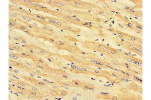 Immunohistochemistry of paraffin-embedded human heart tissue using ABIN7158953 at dilution of 1:100 (MLYCD antibody  (AA 40-493))