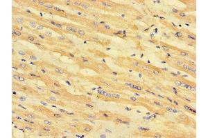 Immunohistochemistry of paraffin-embedded human heart tissue using ABIN7158953 at dilution of 1:100 (MLYCD antibody  (AA 40-493))