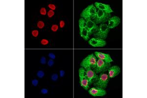 ABIN6265232 and ABIN6278671 staining Hela cells by IF/ICC.
