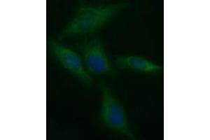 Image no. 2 for anti-Tyrosine Hydroxylase (TH) antibody (ABIN1501369) (Tyrosine Hydroxylase antibody)