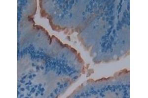 #VALUE! (IL22R antibody  (AA 258-552))