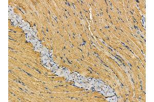 ABIN7095237 and ABIN7099294 at 1/100 staining rat muscle tissue by IHC-P. (TRIM72 antibody)