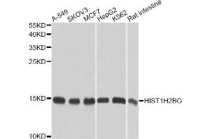 Western blot analysis of extracts of various cell lines, using HIST1H2BG antibody (ABIN6003628) at 1/1000 dilution. (HIST1H2BG antibody)