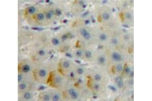 Used in DAB staining on fromalin fixed paraffin-embedded Liver tissue (CD36 antibody  (AA 91-311))