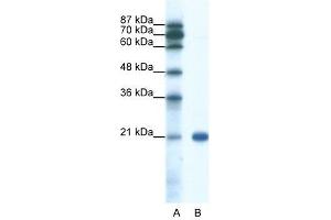 SSX2 antibody used at 0. (SSX2 antibody  (C-Term))