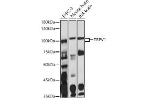 Western blot analysis of extracts of various cell lines, using TRPV1 antibody (ABIN6133947, ABIN6149596, ABIN6149597 and ABIN6224662) at 1:1000 dilution. (TRPV1 antibody  (AA 400-500))