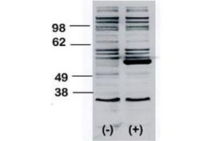 Western blot analysis of BLK polyclonal antibody  transiently transfected HEK293 cell line lysate (1 ug/lane). (BLK antibody  (N-Term))