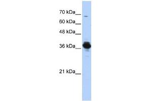 ATP6V0D2 antibody used at 1 ug/ml to detect target protein. (ATP6V0D2 antibody  (Middle Region))