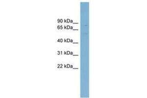 Image no. 1 for anti-ATP-Binding Cassette, Sub-Family G (WHITE), Member 5 (ABCG5) (AA 287-336) antibody (ABIN6744748) (ABCG5 antibody  (AA 287-336))