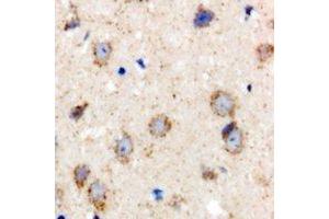 Immunohistochemical analysis of BCS1L staining in rat brain formalin fixed paraffin embedded tissue section. (BCS1L antibody)
