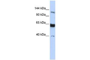 WB Suggested Anti-SYCP1 Antibody Titration: 0. (SYCP1 antibody  (N-Term))