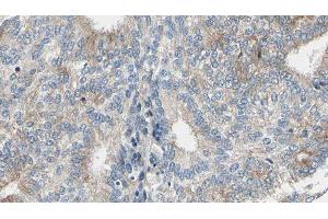 ABIN6277038 at 1/100 staining Human prostate tissue by IHC-P. (ADH5 antibody  (C-Term))