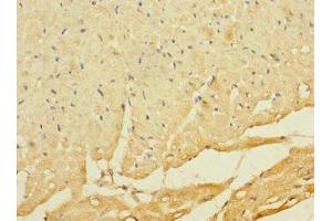 Immunohistochemistry of paraffin-embedded human heart tissue using ABIN7174908 at dilution of 1:100 (C8ORF74 antibody  (AA 1-294))