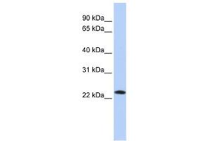 SDF2 antibody used at 1 ug/ml to detect target protein. (SDF2 antibody  (Middle Region))