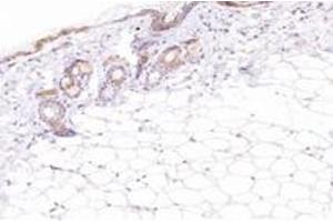 SPINK7/ECRG2 antibody