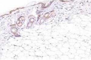 Immunohistochemistry analysis of paraffin-embedded mouse skin using,ECRG-2 (ABIN7075552) at dilution of 1: 2600 (SPINK7/ECRG2 antibody)