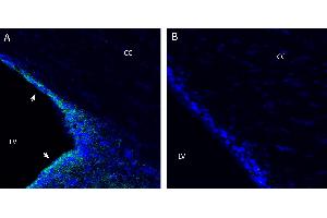 Free-floating frozen brain sections from a paraformaldehyde-perfused rat were incubated with Anti-OCTN2/SLC22A5 Antibody (ABIN7885461, 1:300), followed by goat anti-rabbit secondary antibody conjugated to Alexa Fluor® 488 (green).