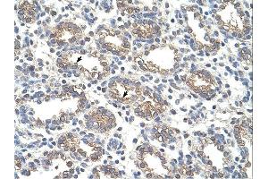 Arginase 1 antibody was used for immunohistochemistry at a concentration of 4-8 ug/ml. (Liver Arginase antibody  (Arg1, N-Term))