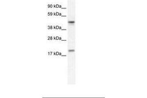 Image no. 1 for anti-Programmed Cell Death 4 (PDCD4) (N-Term) antibody (ABIN6735963) (PDCD4 antibody  (N-Term))