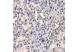 Immunohistochemistry of paraffin-embedded Rat kidney using DDX41 antibody at dilution of 1:100 (x400 lens). (DDX41 antibody)