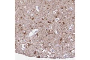 Immunohistochemical staining (Formalin-fixed paraffin-embedded sections) of human cerebral cortex with DCLK2 polyclonal antibody  shows moderate cytoplasmic positivity in neuronal cells at 1:50-1:200 dilution. (DCLK2 antibody)