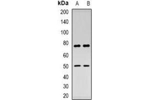 Western blot analysis of Thymopoietin expression in HepG2 (A), mouse kidney (B) whole cell lysates.