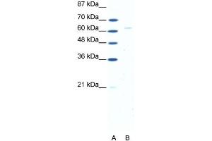 WB Suggested Anti-FOXN1 Antibody Titration: 5. (FOXN1 antibody  (N-Term))