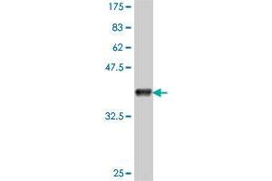 Western Blot detection against Immunogen (37. (CACUL1 antibody  (AA 111-210))