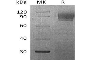 Western Blotting (WB) image for Interferon alpha/beta Receptor 1 (IFNAR1) protein (His tag) (ABIN7320999) (IFNAR1 Protein (His tag))
