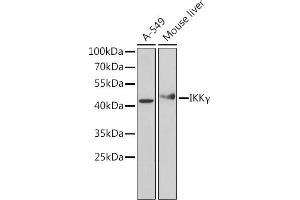 Western blot analysis of extracts of various cell lines, using IKKγ Antibody (ABIN6130478, ABIN6142284, ABIN6142286 and ABIN7101404) at 1:1000 dilution. (IKBKG antibody  (AA 1-419))