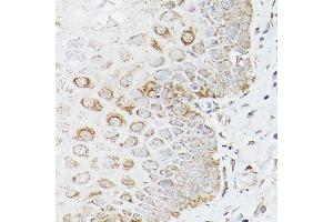 Immunohistochemistry of paraffin-embedded human esophageal using [KO Validated] Glutamine Synthetase (Glutamine Synthetase (GLUL)) Rabbit pAb (ABIN6130425, ABIN6141161, ABIN6141162 and ABIN7101772) at dilution of 1:150 (40x lens).