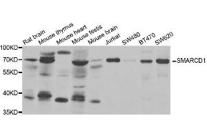 Western blot analysis of extracts of various cell lines, using SMARCD1 antibody. (SMARCD1 antibody  (AA 216-515))