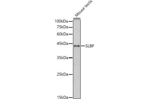 SLBP antibody