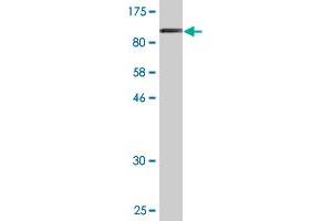 Western Blot detection against Immunogen (91. (LIMA1 antibody  (AA 1-598))