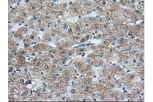 Immunohistochemical staining of paraffin-embedded Human liver tissue using anti-C9orf41 mouse monoclonal antibody. (C9orf41 antibody)