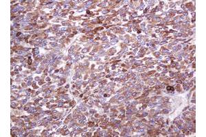 Image no. 1 for anti-Mucin 1 (MUC1) antibody (ABIN1499598) (MUC1 antibody)