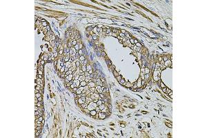 Immunohistochemistry of paraffin-embedded human prostate using CPOX antibody (ABIN5971997) at dilution of 1/100 (40x lens). (CPOX antibody)
