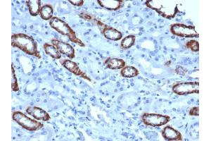 IHC analysis of formalin-fixed, paraffin-embedded human kidney. (TOM1L1 antibody)