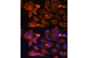 Immunofluorescence analysis of C6 cells using RPS8 antibody (ABIN7270041) at dilution of 1:100. (RPS8 antibody)