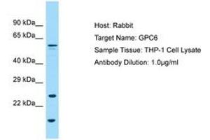 Image no. 1 for anti-Glypican 6 (GPC6) (AA 36-85) antibody (ABIN6749994) (Glypican 6 antibody  (AA 36-85))