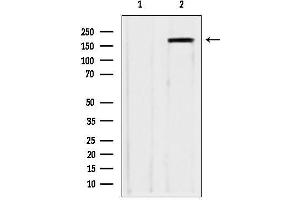 anti-Zinc Finger, CCHC Domain Containing 11 (ZCCHC11) (Internal Region) antibody