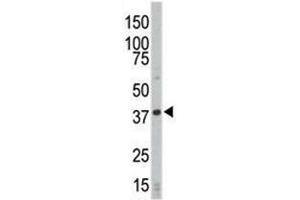Western blot analysis of CDK4 antibody and HL-60 cell lysate (CDK4 antibody  (AA 273-305))